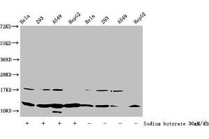 Western Blot Detected samples: Hela whole cell lysate, 293 whole cell lysate, A549 whole cell lysate, HepG2 whole cell lysate, Untreated (-) or treated (+) with 30 mM sodium butyrate for 4h All lanes: HIST1H4A antibody at 1:100 Secondary Goat polyclonal to rabbit IgG at 1/50000 dilution Predicted band size: 12 kDa Observed band size: 12 kDa (HIST1H4A Antikörper  (acLys31))