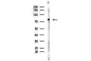 anti-Cyclic Nucleotide Gated Channel alpha 1 (CNGA1) (Internal Region) antibody