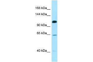 WB Suggested Anti-SMC6 Antibody Titration: 1. (SMC6 Antikörper  (C-Term))