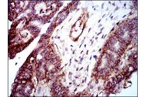 Immunohistochemistry (IHC) image for anti-Integrin beta 1 (ITGB1) antibody (ABIN1844058) (ITGB1 Antikörper)
