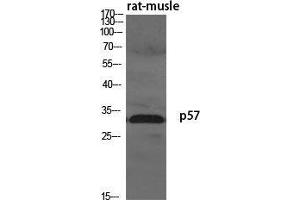 Western Blot (WB) analysis of specific cells using p57 Polyclonal Antibody. (P57 (N-Term) Antikörper)