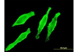 Immunofluorescence of monoclonal antibody to MYL2 on HeLa cell.
