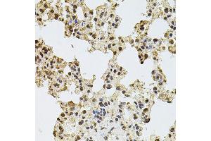 Immunohistochemistry of paraffin-embedded rat lung using ZNF408 antibody (ABIN5974874) at dilution of 1/100 (40x lens). (ZNF408 Antikörper)