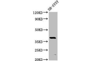 Western Blot Positive WB detected in: SH-SY5Y whole cell lysate All lanes: MKX antibody at 6 μg/mL Secondary Goat polyclonal to rabbit IgG at 1/50000 dilution Predicted band size: 40 kDa Observed band size: 40 kDa (MKX Antikörper  (AA 157-305))