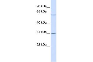 WB Suggested Anti-TMEM106C Antibody Titration:  0. (TMEM106C Antikörper  (Middle Region))