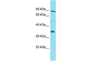 Western Blotting (WB) image for anti-Galactosidase, beta 1-Like 3 (GLB1L3) (C-Term) antibody (ABIN2791555) (GLB1L3 Antikörper  (C-Term))