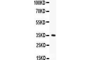 Anti- FAS Picoband antibody, Western blotting All lanes: Anti FAS  at 0. (FAS Antikörper  (AA 26-173))