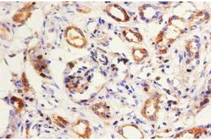 Immunohistochemistry of paraffin-embedded human kidney tissue using ABIN7157681 at dilution of 1:50 (KNG1 Antikörper  (AA 390-644))