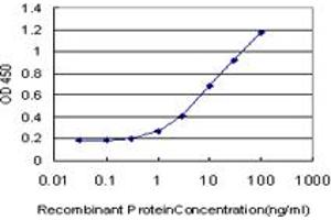 Detection limit for recombinant GST tagged IRAK3 is approximately 0. (IRAK3 Antikörper  (AA 497-596))