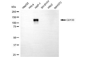 Western blotting analysis using CD133 antibody (ABIN7800959). (Rekombinanter Prominin Antikörper)