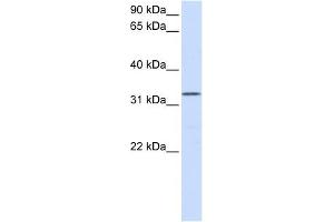 DOK5 antibody used at 1 ug/ml to detect target protein. (DOK5 Antikörper  (N-Term))