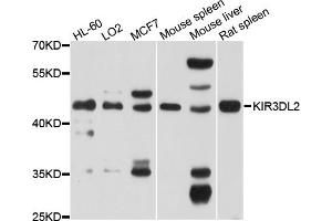Western blot analysis of extracts of various cell lines, using KIR3DL2 antibody (ABIN4904158) at 1:1000 dilution.