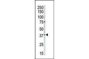 CSNK1A1 Antikörper  (C-Term)