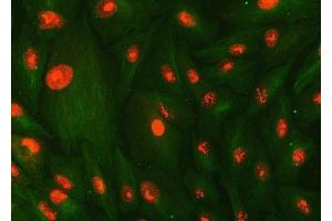 IF analysis of SMC1A and Tubulin beta using anti-SMC1A antibody (ABIN7602089) and anti-Tubulin beta antibody (ABIN7602744).