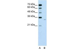 WB Suggested Anti-DCXR Antibody Titration:  0.