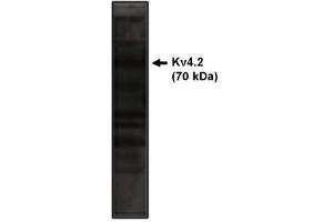 Image no. 1 for anti-Potassium Voltage-Gated Channel, Shal-Related Subfamily, Member 2 (KCND2) antibody (ABIN265029) (KCND2 Antikörper)