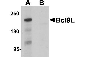 Western blot analysis of Bcl9L in HeLa cell lysate with Bcl9L antibody at 1 µg/mL in (A) the absence and (B) the presence of blocking peptide. (BCL9L Antikörper  (N-Term))