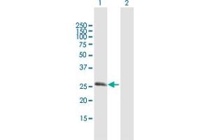 Western Blot analysis of RGS20 expression in transfected 293T cell line by RGS20 MaxPab polyclonal antibody. (RGS20 Antikörper  (AA 1-241))