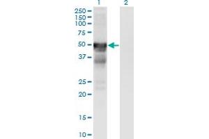 Western Blot analysis of RGMA expression in transfected 293T cell line by RGMA monoclonal antibody (M01), clone 6D7.