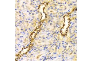Immunohistochemistry of paraffin-embedded Rat kidney using CPT2 antibody at dilution of 1:100 (x400 lens). (CPT2 Antikörper)