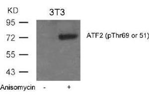 Image no. 3 for anti-Activating Transcription Factor 2 (ATF2) (pThr51), (pThr69) antibody (ABIN196664) (ATF2 Antikörper  (pThr51, pThr69))