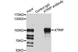 Immunoprecipitation analysis of 200ug extracts of HeLa cells using 1ug ATRIP antibody. (ATRIP Antikörper  (AA 1-260))