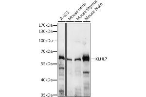 Western blot analysis of extracts of various cell lines, using KLHL7 antibody (ABIN7268080) at 1:3000 dilution. (KLHL7 Antikörper  (AA 200-300))