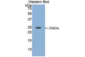 Western Blotting (WB) image for anti-KH Domain Containing, RNA Binding, Signal Transduction Associated 1 (KHDRBS1) (AA 156-381) antibody (ABIN1859527) (KHDRBS1 Antikörper  (AA 156-381))