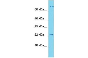 Host: Rabbit Target Name: APOPT1 Sample Type: Jurkat Whole Cell lysates Antibody Dilution: 1. (APOPT1 Antikörper  (C-Term))