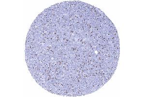 anti-zeta-Chain (TCR) Associated Protein Kinase 70kDa (ZAP70) (AA 247-382) antibody