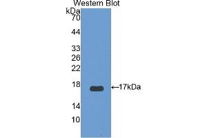 Western blot analysis of the recombinant protein. (UCP2 Antikörper  (AA 154-289))