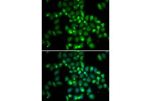 Immunofluorescence analysis of HeLa cell using PCGF6 antibody. (PCGF6 Antikörper)