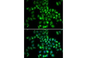 Immunofluorescence analysis of HeLa cell using PCGF6 antibody.