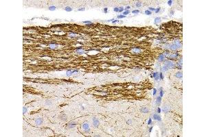 Immunohistochemistry of paraffin-embedded Rat brain using NEFL Polyclonal Antibody at dilution of 1:200 (40x lens). (NEFL Antikörper)