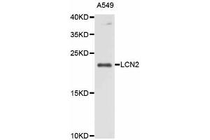Western blot analysis of extracts of A-549 cells, using LCN2 antibody. (Lipocalin 2 Antikörper)