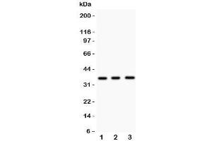 Western blot testing of Nkx2-5 antibody and Lane 1:  mouse spleen;  2: mouse heart;  3: human HeLa lysate.