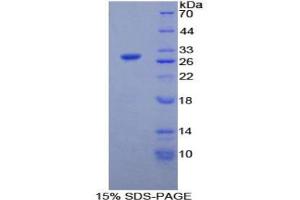 SDS-PAGE analysis of Rat iPLA2 Protein. (PNPLA2 Protein)