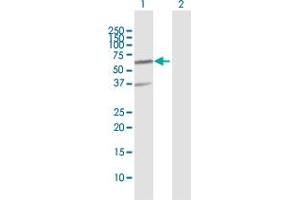 Western Blot analysis of RNF25 expression in transfected 293T cell line by RNF25 MaxPab polyclonal antibody. (RNF25 Antikörper  (AA 1-459))
