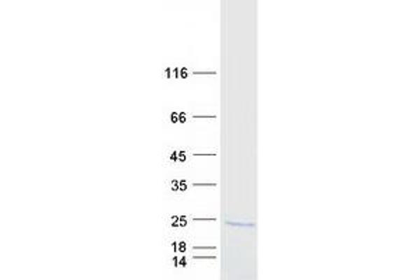 PLA2G12B Protein (Myc-DYKDDDDK Tag)