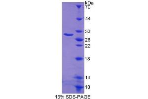 SDS-PAGE (SDS) image for BCL2-Like 1 (BCL2L1) (AA 2-212) protein (His tag) (ABIN1078941) (BCL2L1 Protein (AA 2-212) (His tag))