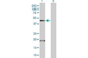 Western Blot analysis of TMPRSS11D expression in transfected 293T cell line by TMPRSS11D MaxPab polyclonal antibody. (TMPRSS11D Antikörper  (AA 1-418))