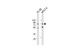 All lanes : Anti-CBFA2T3 Antibody at 1:500-1:2000 dilution Lane 1: HL-60 whole cell lysate Lane 2: MOLT-4 whole cell lysate Lysates/proteins at 20 μg per lane. (CBFA2T3 Antikörper  (AA 418-653))