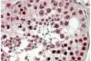 AP21512PU-N CIRBP antibody staining of paraffin embedded Human Testis at 3. (CIRBP Antikörper  (C-Term))