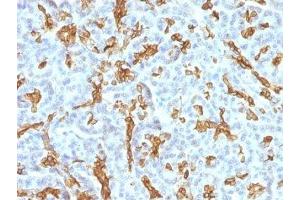 Formalin-fixed, paraffin-embedded human pancreas stained with Cytokeratin 19 antibody (KRT19/799 + KRT19/800) (Cytokeratin 19 Antikörper)