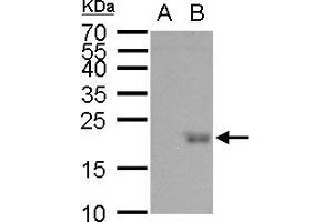 WB Image UBE2B antibody detects UBE2B protein by western blot analysis.