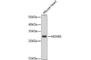 Western blot analysis of extracts of Mouse heart using HOXB1 Polyclonal Antibody at dilution of 1:1000. (HOXB1 Antikörper)
