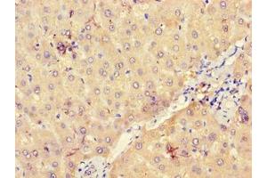 Immunohistochemistry of paraffin-embedded human liver tissue using ABIN7175166 at dilution of 1:100
