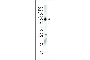 Western blot analysis of anti-PKCnu C-term Pab (ABIN391015 and ABIN2841187) in NCI- cell lysate.