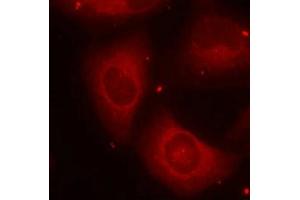 Immunofluorescence staining of methanol-fixed Hela cells using LIMK2(Phospho-Thr505) Antibody. (LIMK2 Antikörper  (pThr505))