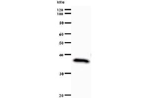 Western Blotting (WB) image for anti-Set1/Ash2 Histone Methyltransferase Complex Subunit ASH2 (ASH2L) antibody (ABIN933109) (ASH2L Antikörper)